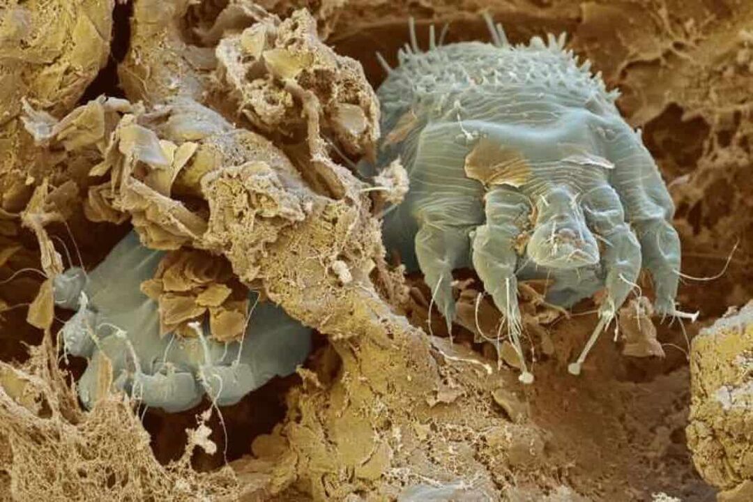 A sarna ácaro baixo o microscopio