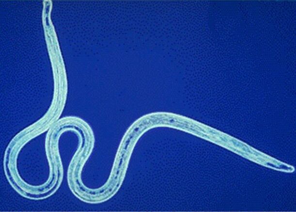 Nematodos no corpo humano